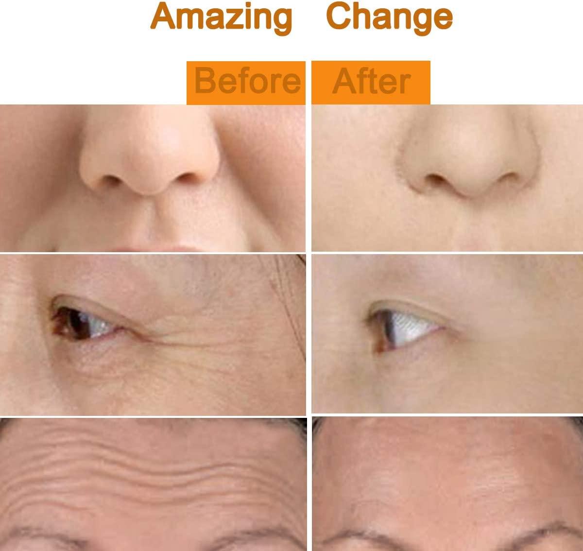 Amirce Electric Face Massage Roller for Eyes & Puffiness Relief