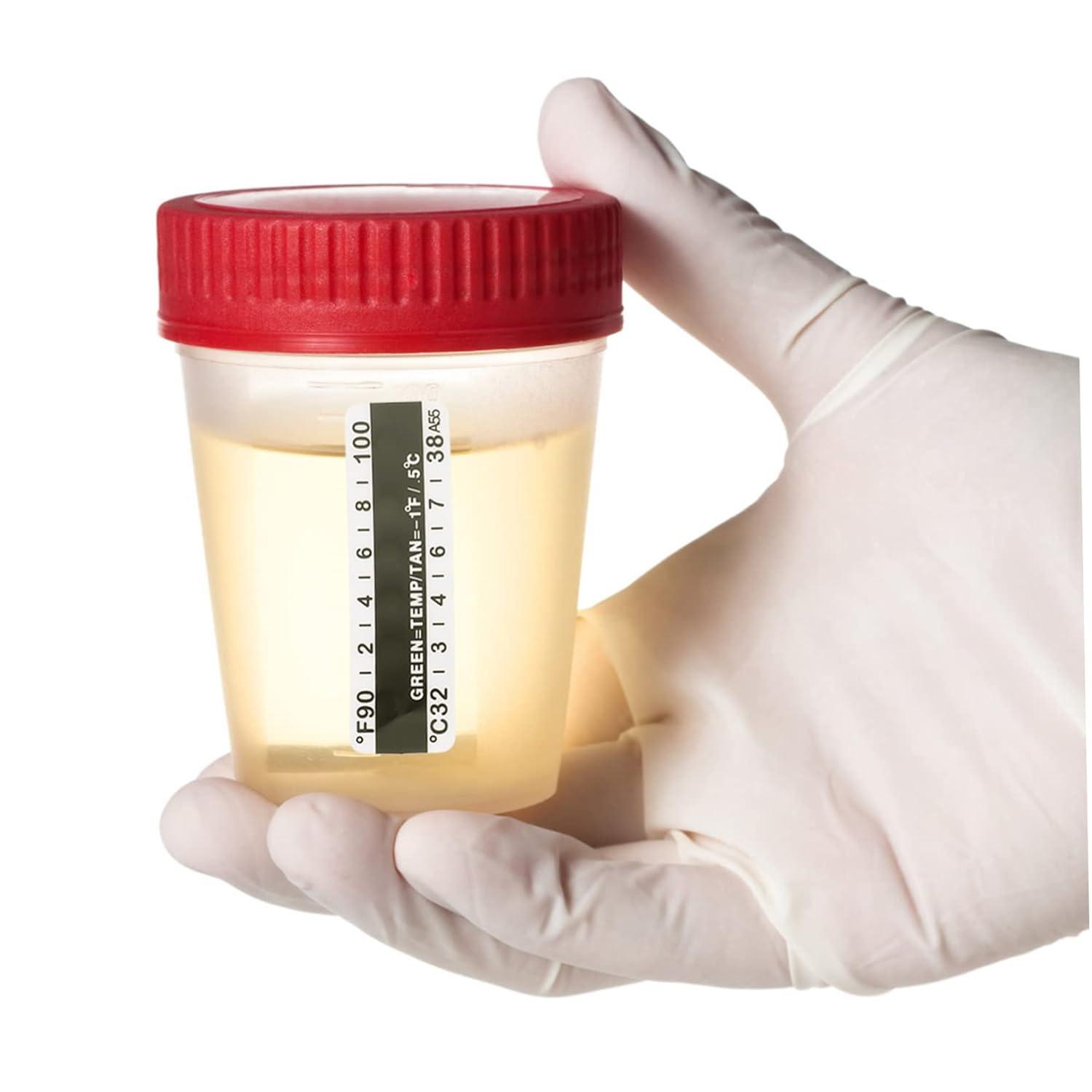 Urine Temp Strips 25pcs Fish Tank Test Strips Urinalysis Sticker