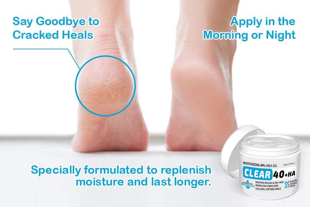 Clear 40 HA 40 Urea Gel 1 Hyaluronic Acid 4 oz w/Tea Tree & Coconut