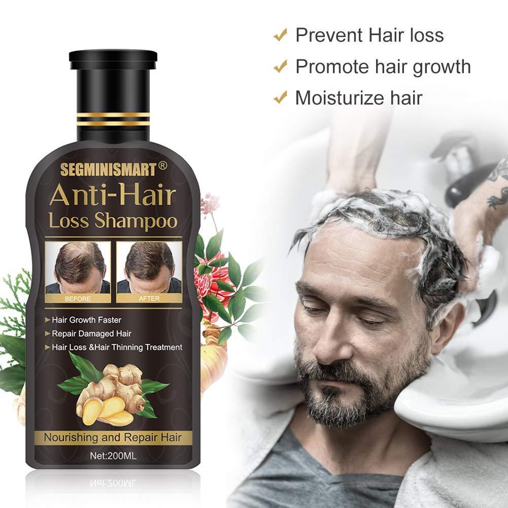Hair Growth Shampoo,AntiHair Loss Shampoo,Hair Loss Shampoo,Hair