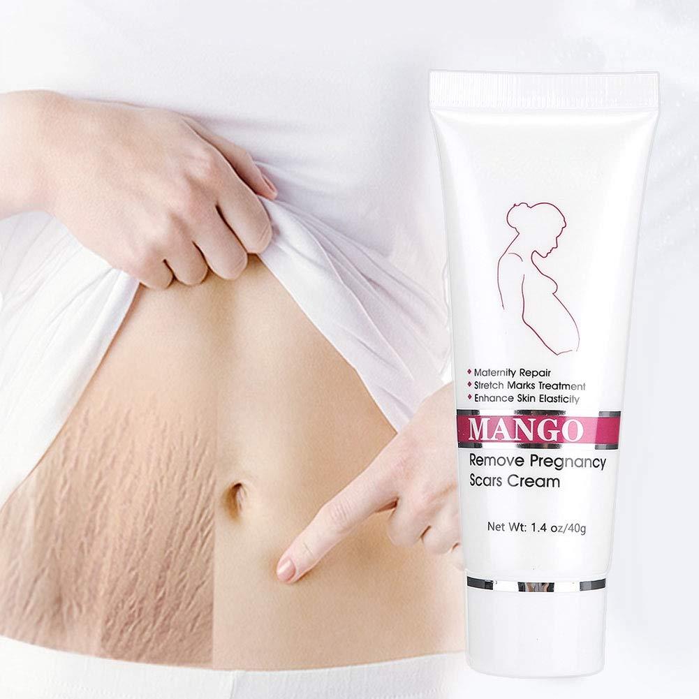 Stretch Mark Cream for Pregnancy & Scars Maternity Repair & Acne Treatment