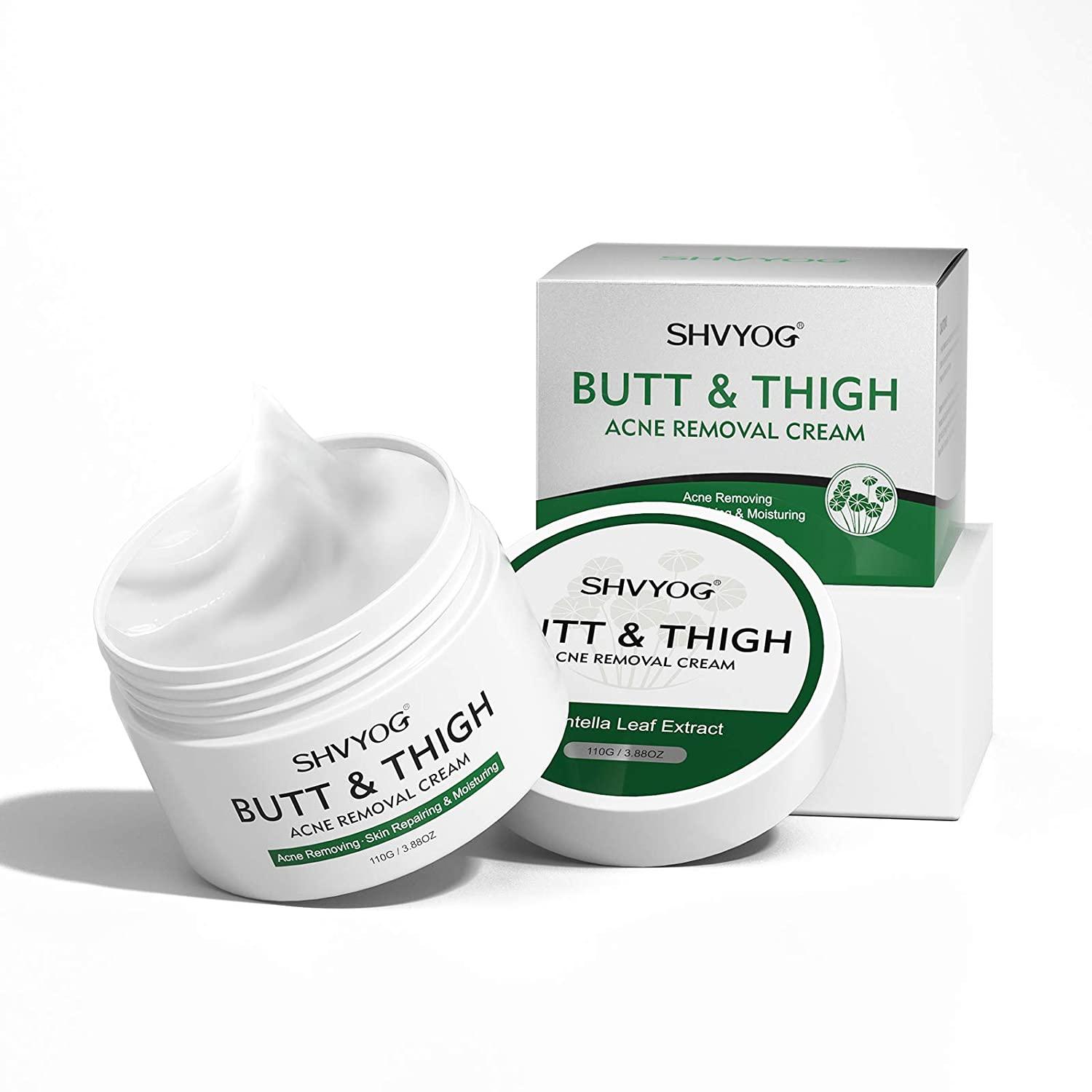 Butt & Thigh Anti Acne Cream,Body Acne Cream,Removing Acne,Pimples and