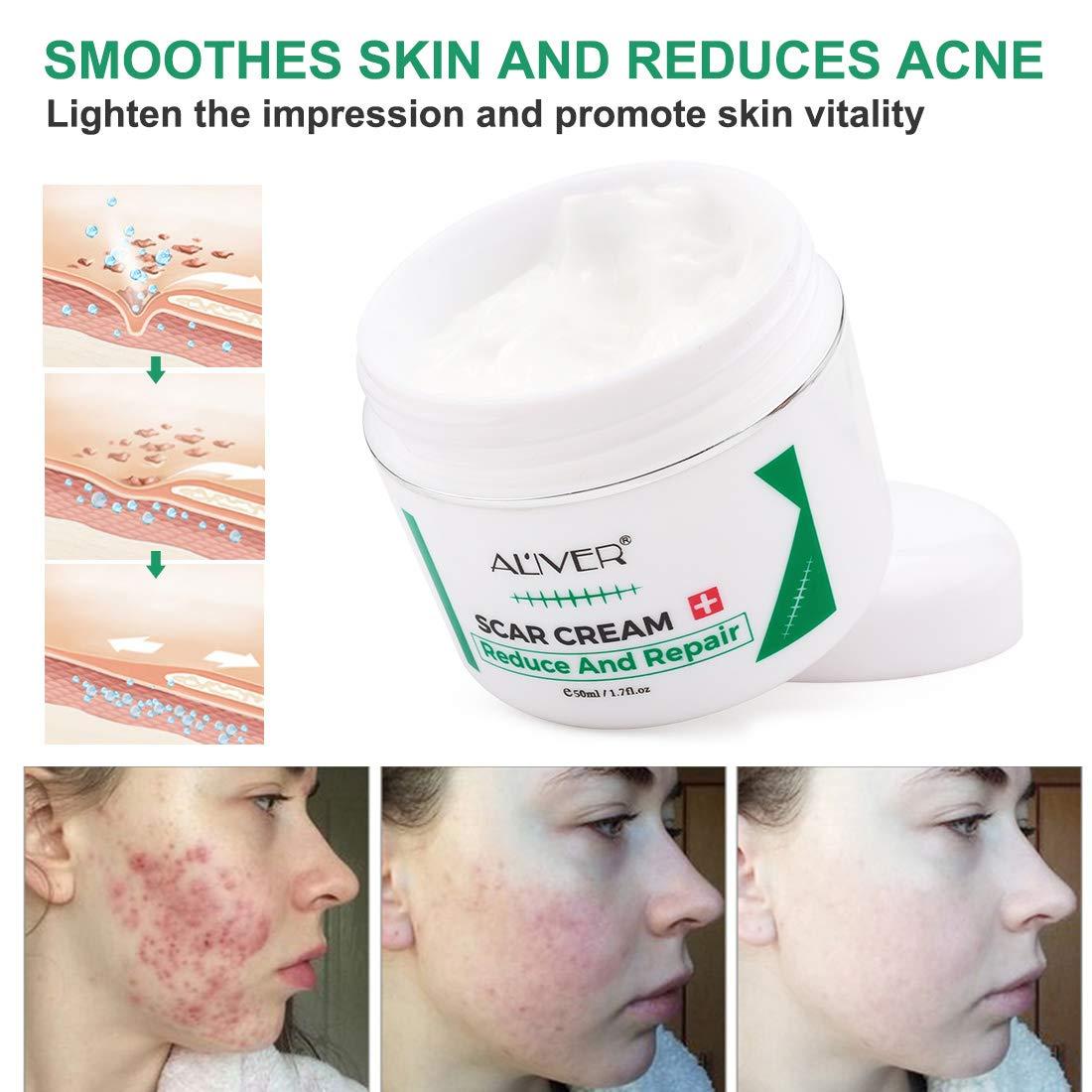 Best scar removal cream for deals legs