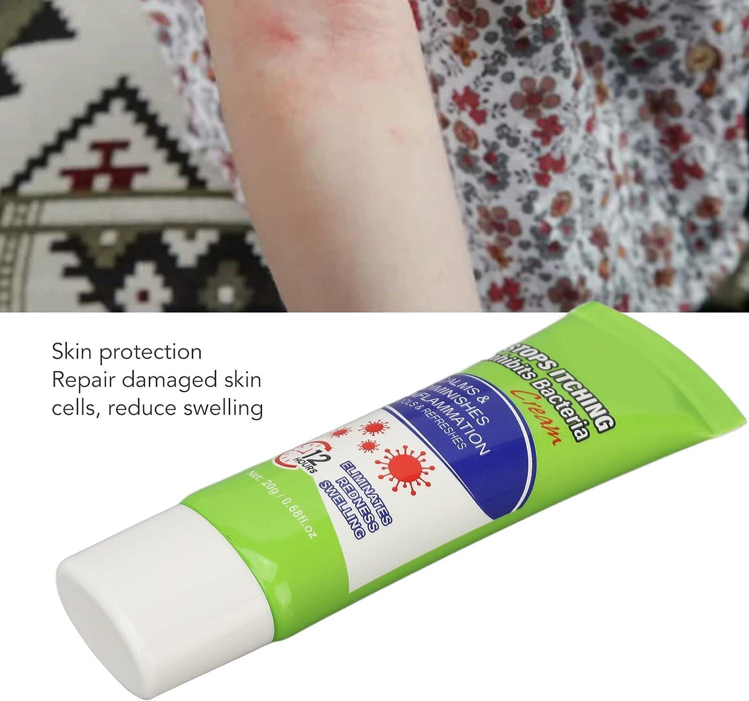 Herbal Extra Strength Itch Stopping Cream for Insect Bites & Eczema