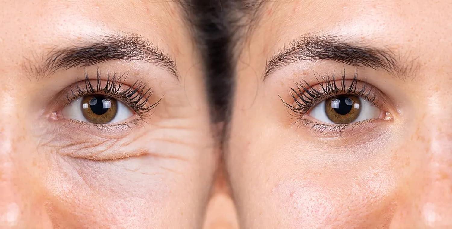 Venofye Royal Jelly Eye Beelift