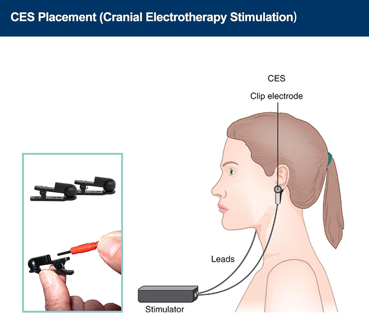 Ear Clip Electrodes for CES Sleep TVNS Vagus Nerve Stimulation for
