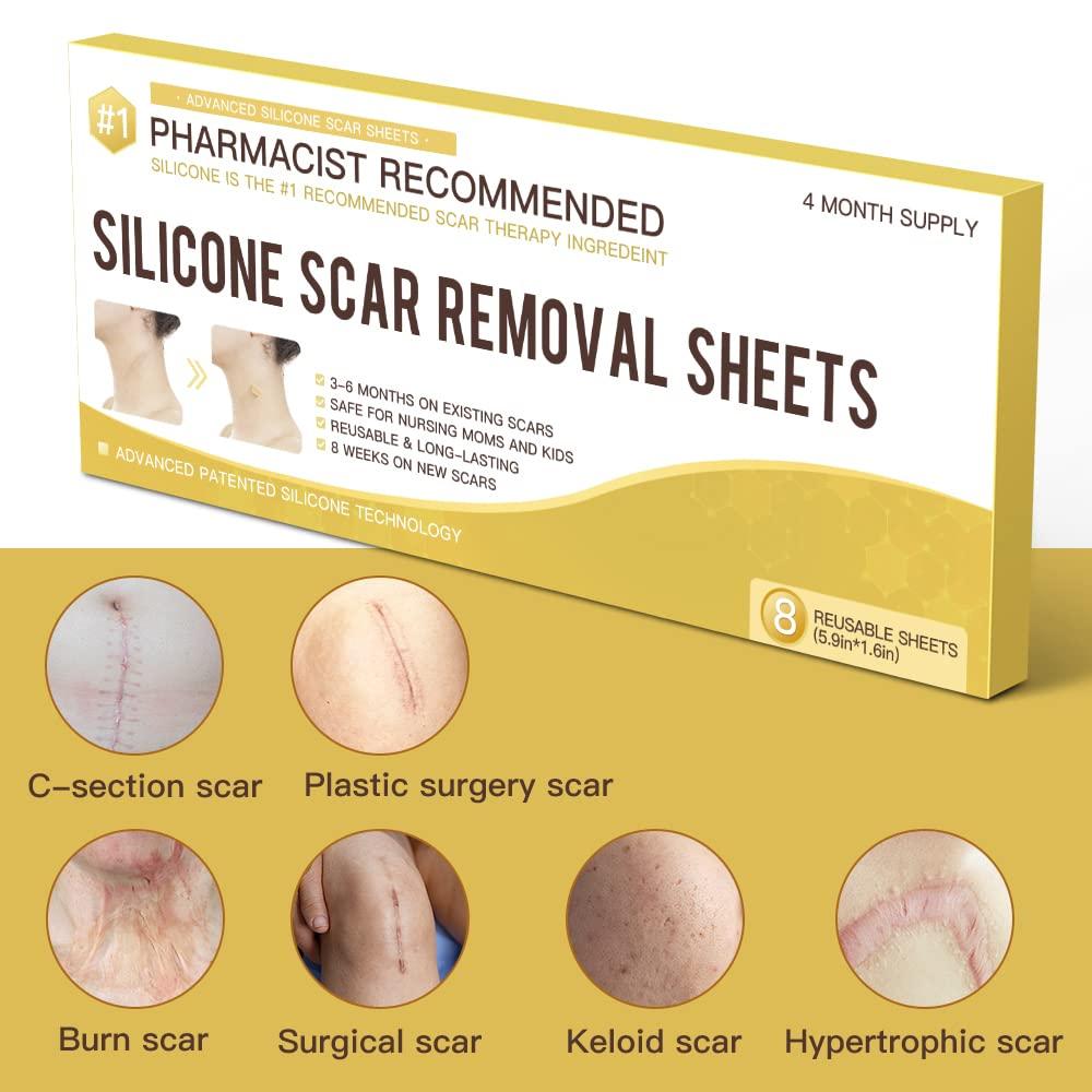 Medical Grade Silicone Scar Removal Sheets Silicon Scar Strips Scars Removal Treatment Silicone