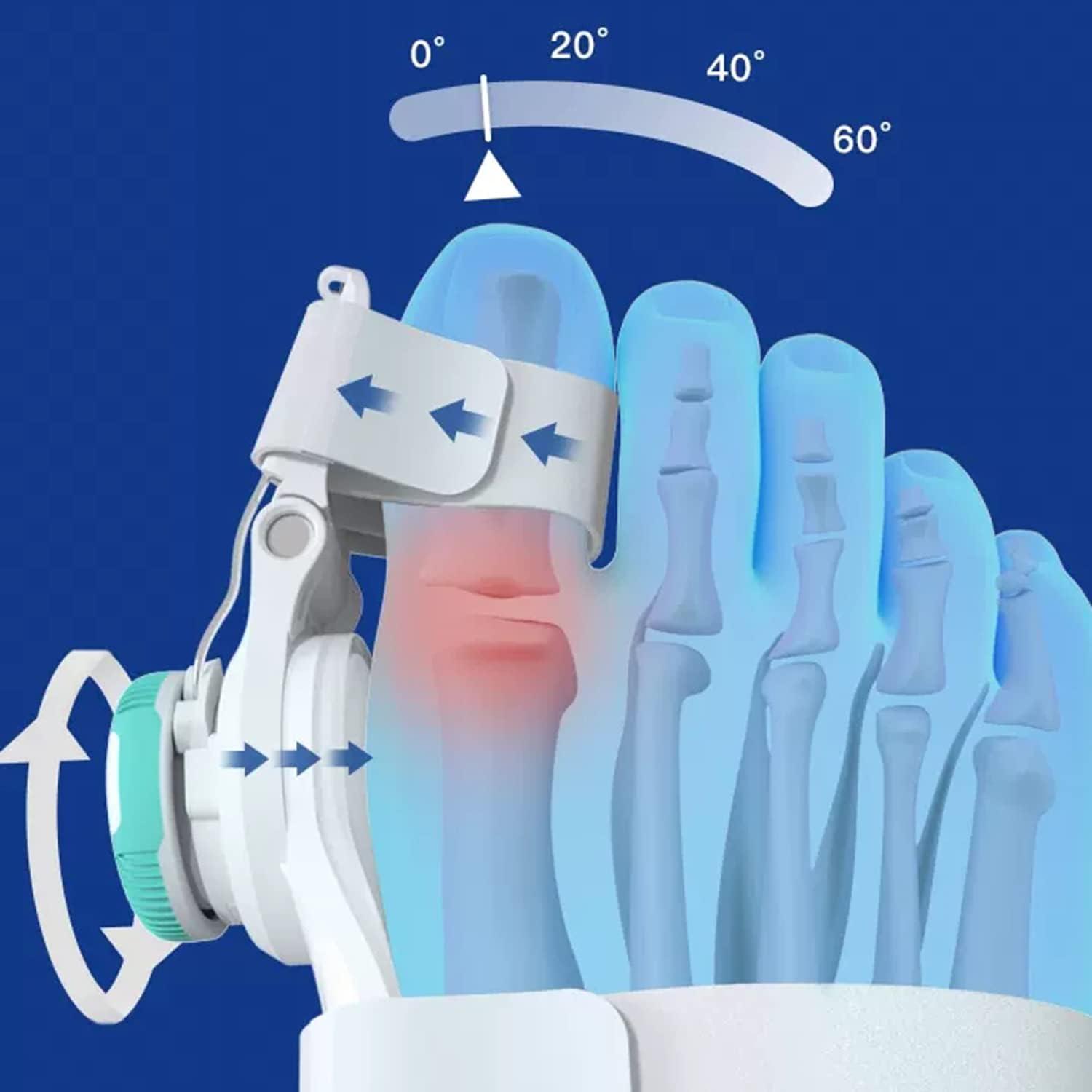 Bunion Corrector with Knob Angle Adjustment Toe Straightener for
