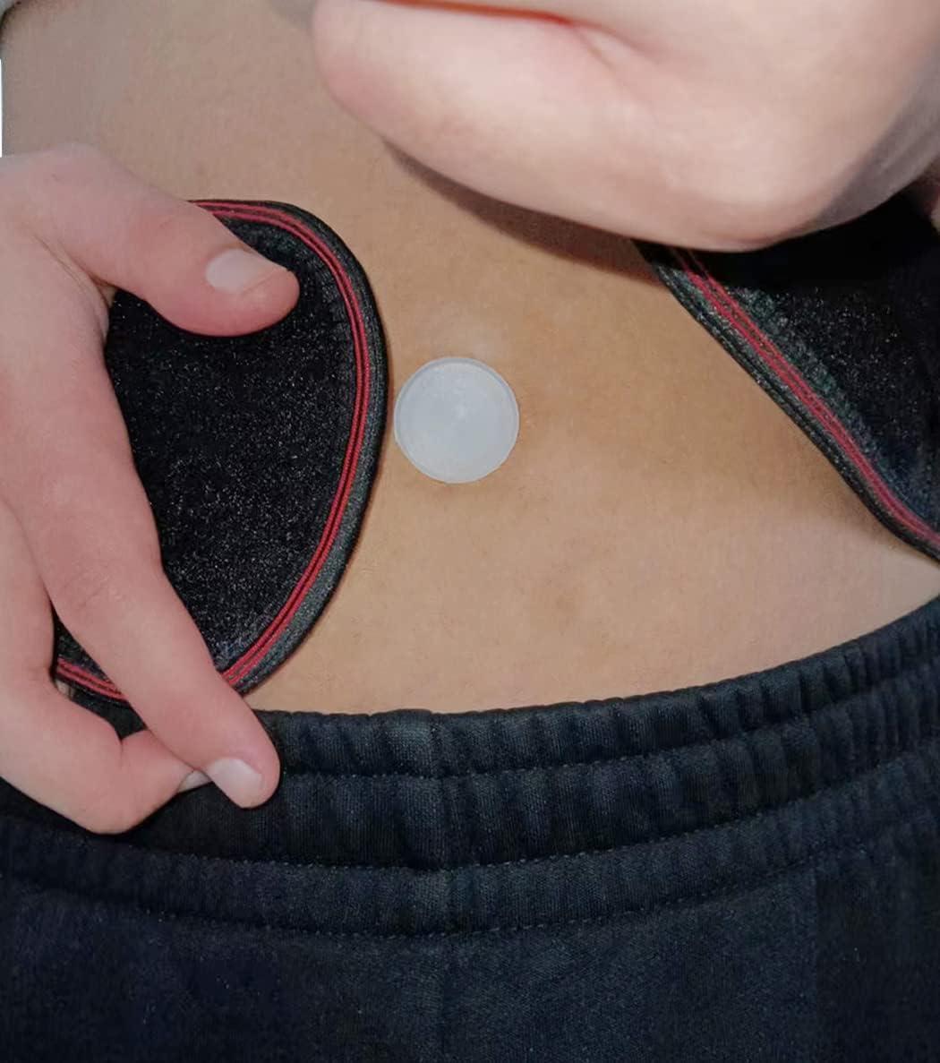 Belly Button Shaper Silicone Plug Tummy Tuck Bariatric Surgery