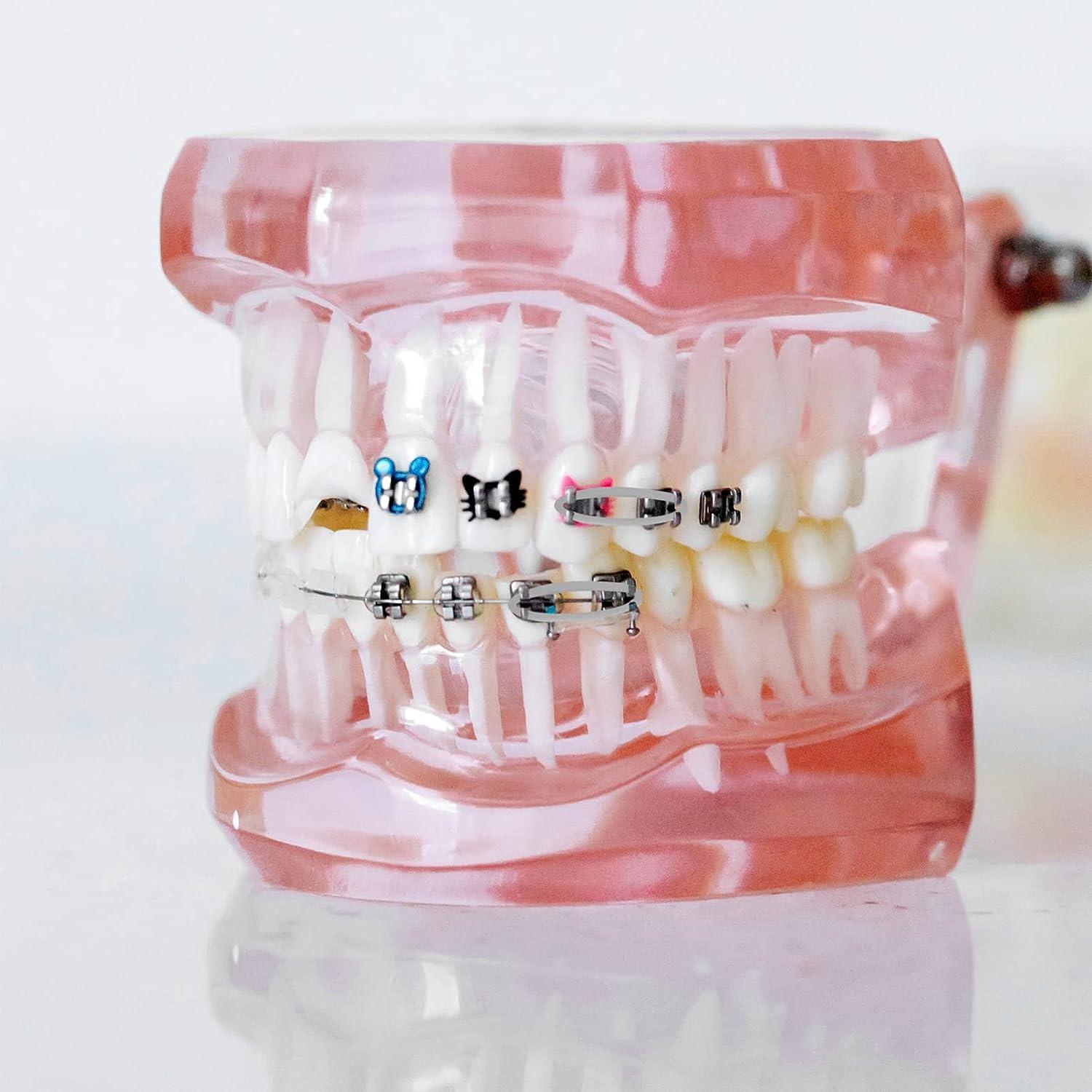 Orthodontic Braces Rubber Chains Elastic Power Chains for Dental Supplies