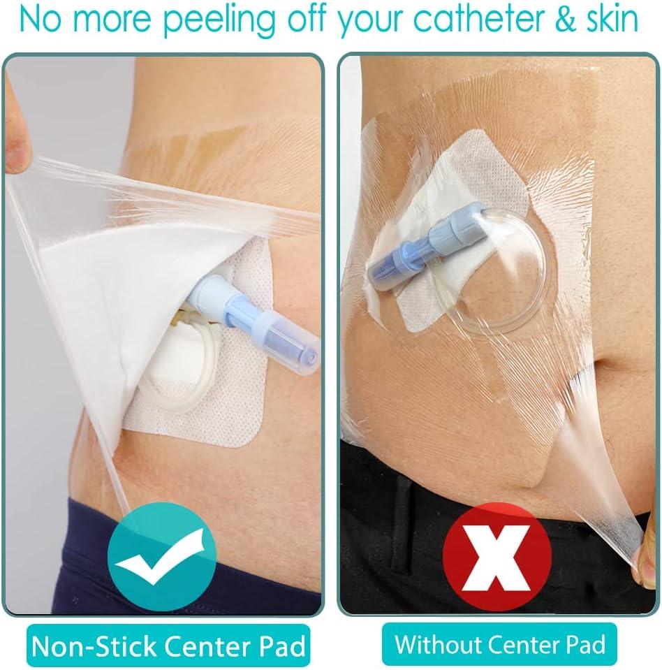 25 Pcs Waterproof Dialysis Catheter Shower Cover + NonStick Center Pad