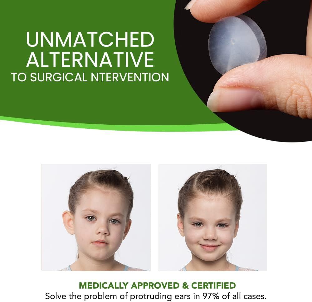 Cosmetic Ear Correctors for Children Pairs of Transparent