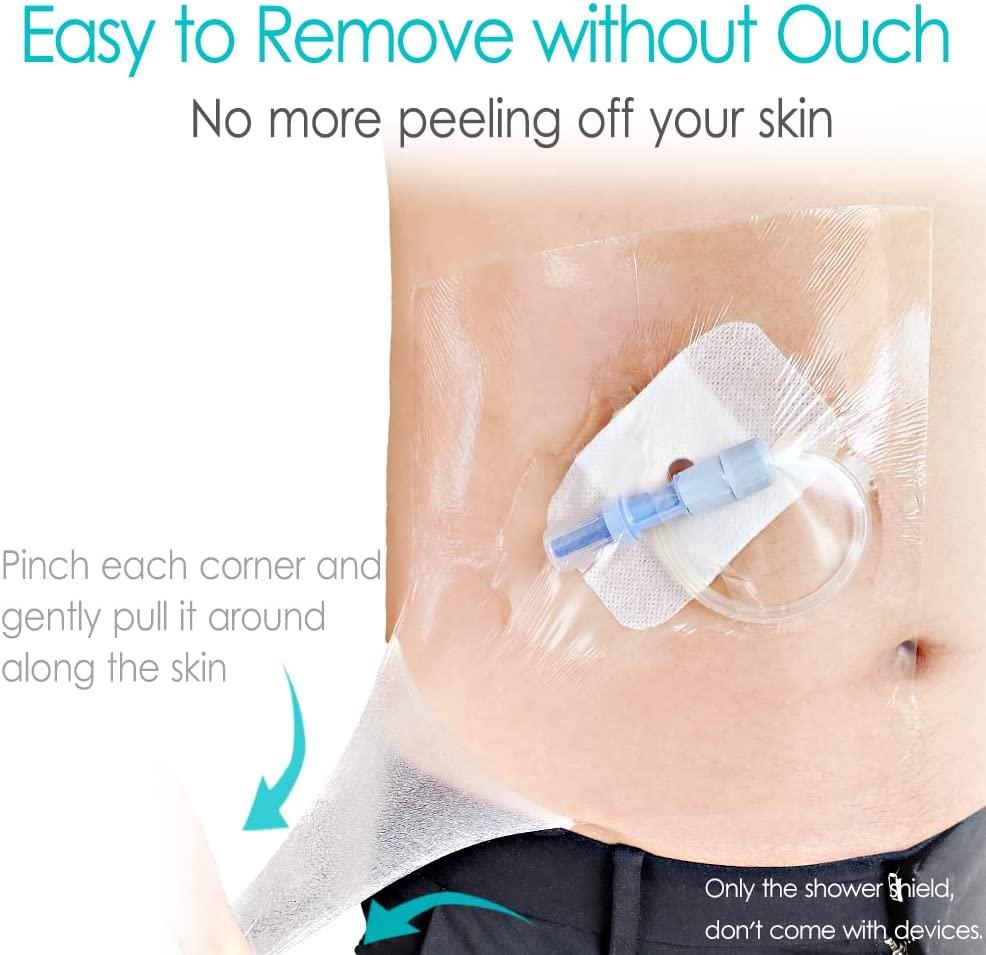 Peritoneal Dialysis Shower Protector Shields, Waterproof Dialysis Port