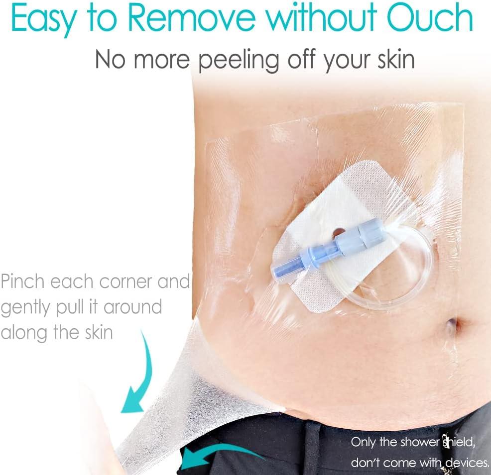 Elastic Waterproof Dialysis Catheter Shower Cover Bandage Roll 6x197