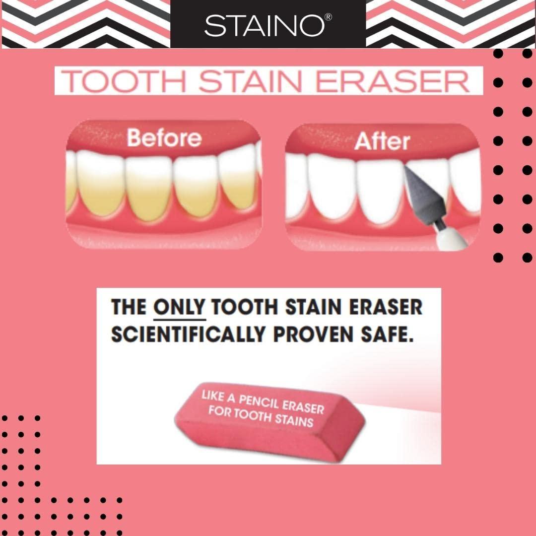 Staino Tooth Stain Eraser Dental Tool 2 Erasers/Unit