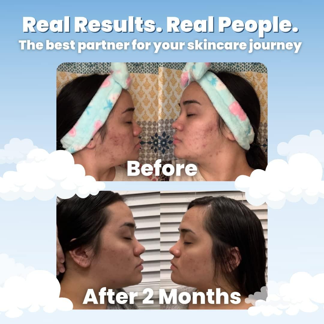 Clean Skin Club Clean Towels World's 1st AcneFighting Biodegradable