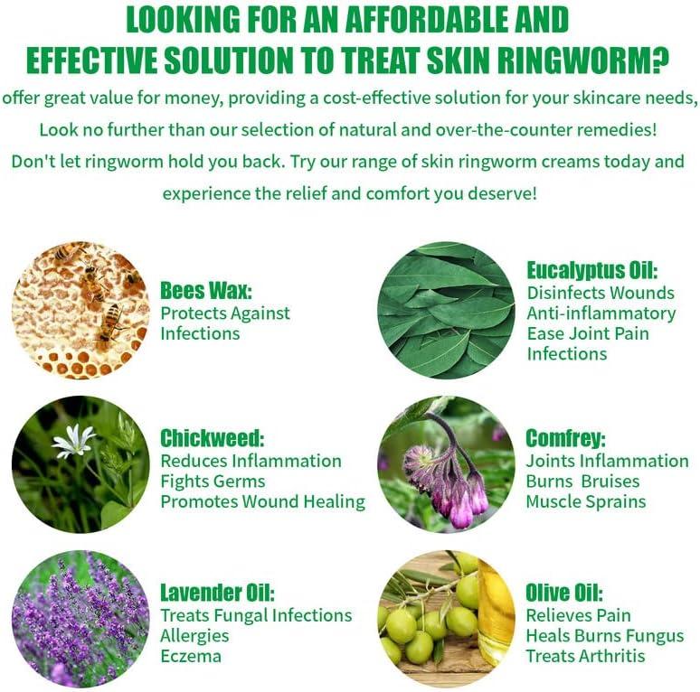 Tea Tree Oil Balm Heat Rash Cream Tinea Versicolor Itchy Feet Butt Rash Anal Itch Boil Cyst Itch