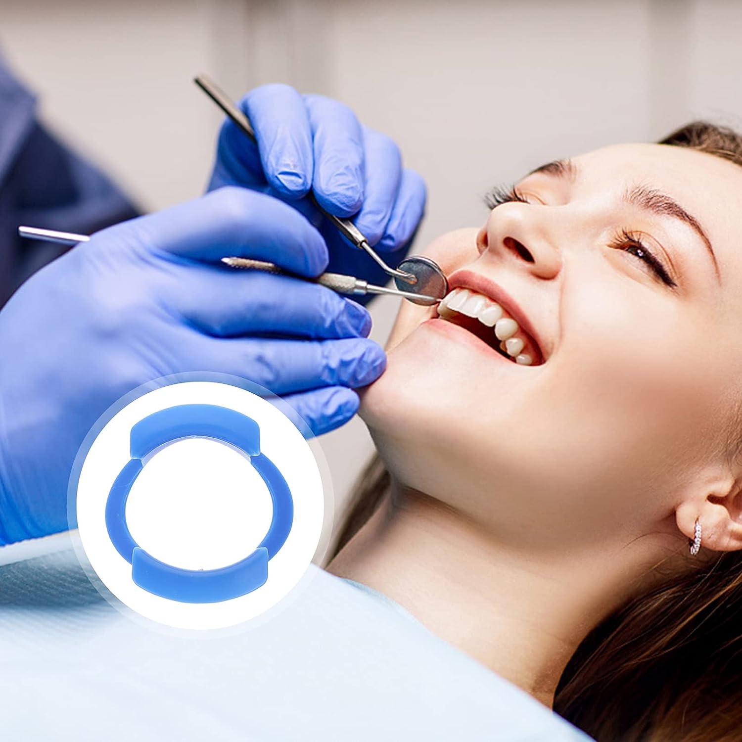 2pcs O Oral Watch Speak Orthodontics Tool Lipless Shape for Mouthguard Teeth White Orthodontic