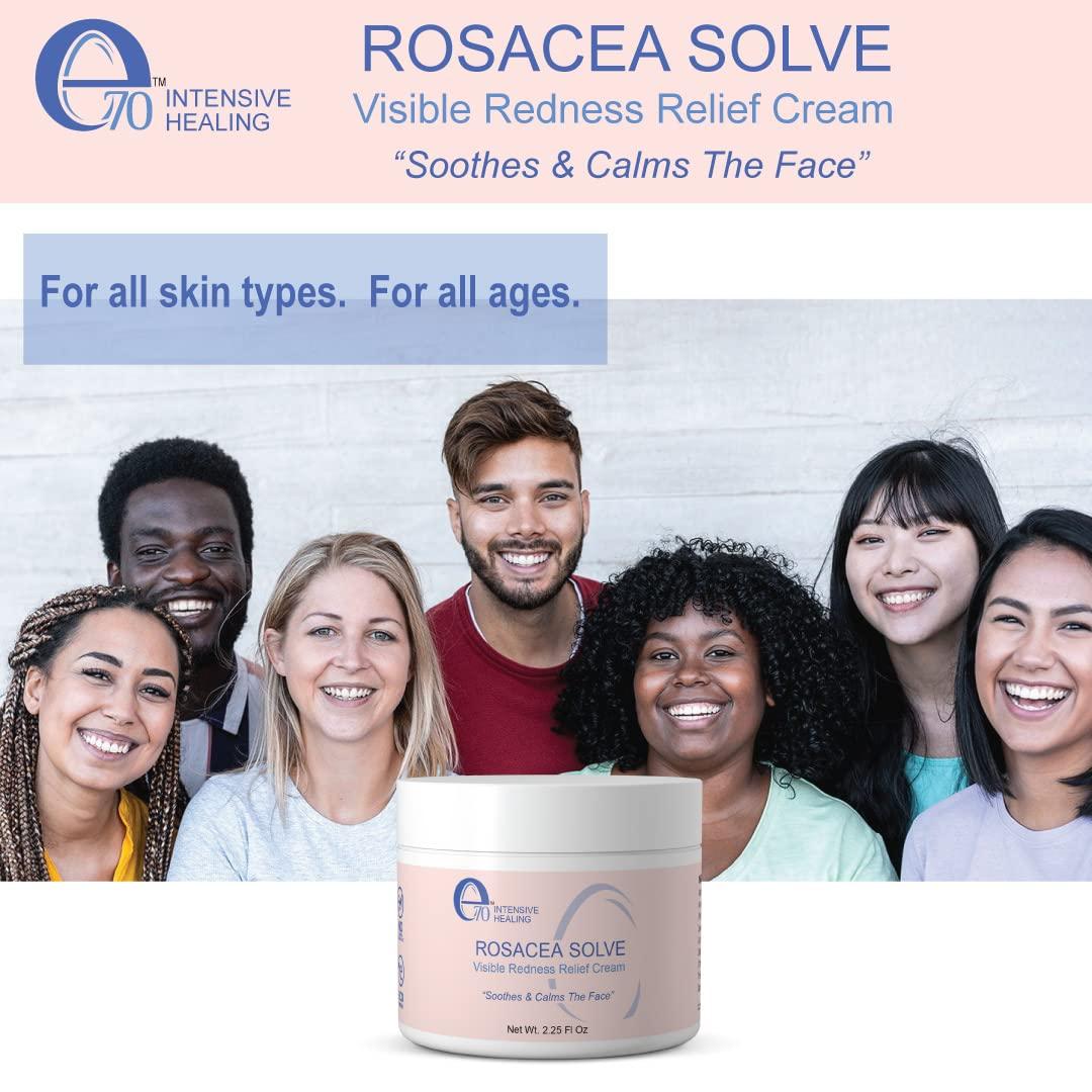 E70 Rosacea Solve Redness Relief Cream Calming Face Moisturizer For