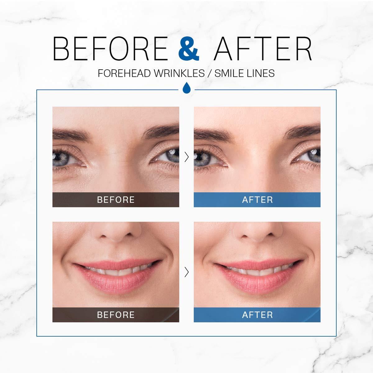 GD11 HYDRACELL AQUA AMPOULE STEM CELL BOOSTER SERUM for Antiaging