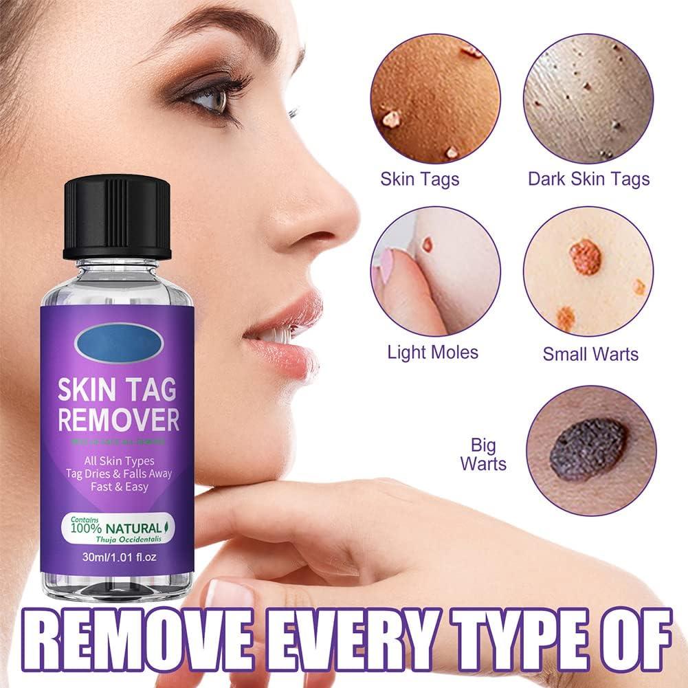 LDREAMAM Skin Tag Removal Wart & Mole Remover Skin Tag Removal
