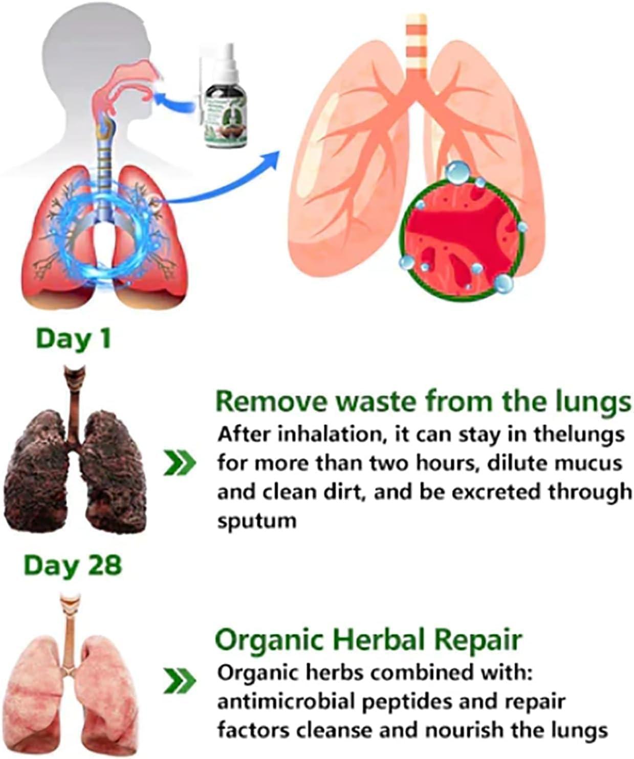 Respinature Herbal Lung Cleanse Mist-Powerful Lung Support Cleanse &  Breathe 30 Ml Respinature Herbal Spray 5 Natural Plant Extracts 4 Weeks  Powerful Lung Support & Cleanse & Respiratory (1pc)