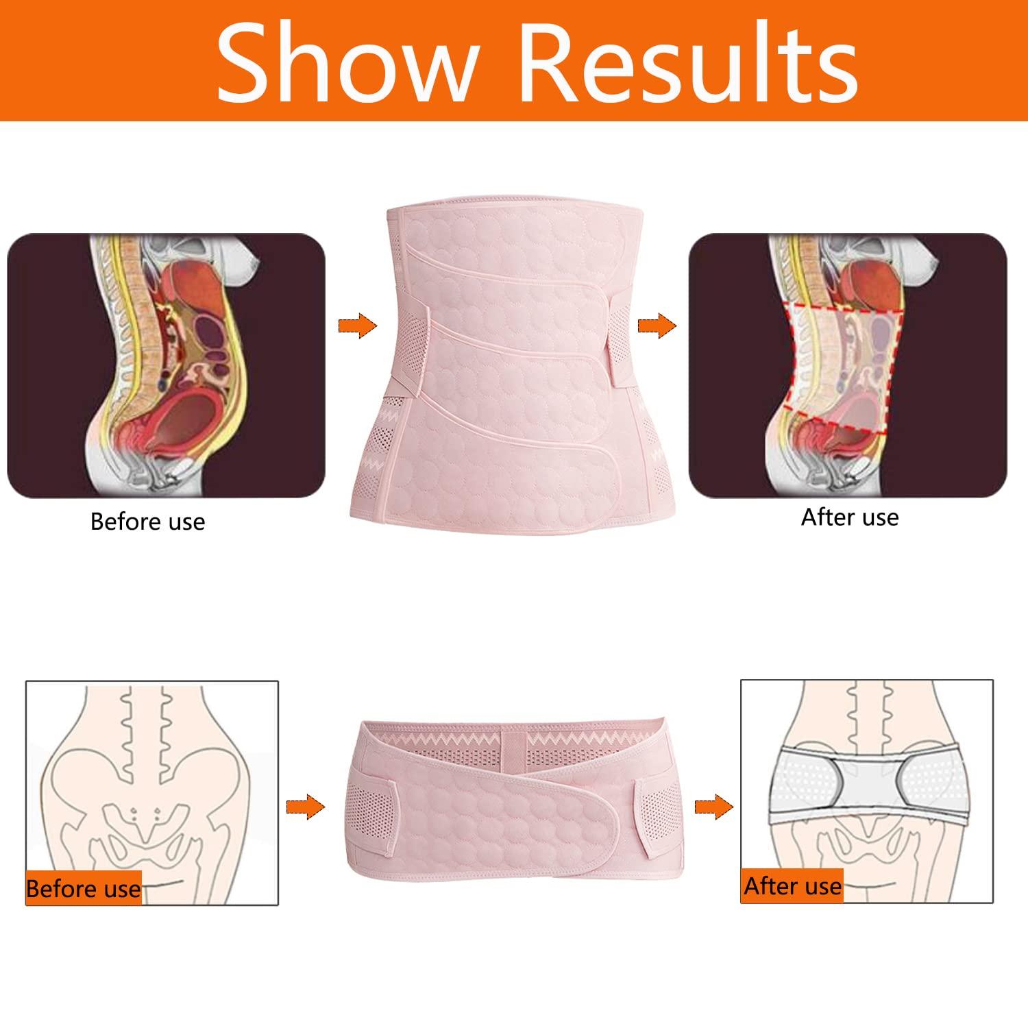 WANYI 4patch Postpartum Belly Wrap with Pelvis Belt 2 in 1 CSection