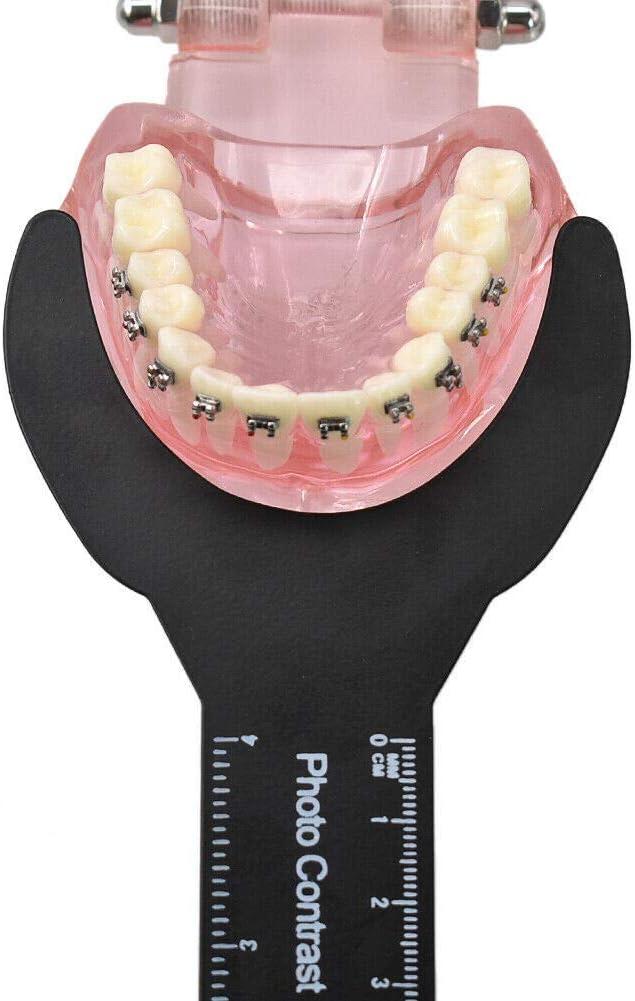 Dental Oral Image Contraster Palatal Photographic Black Background