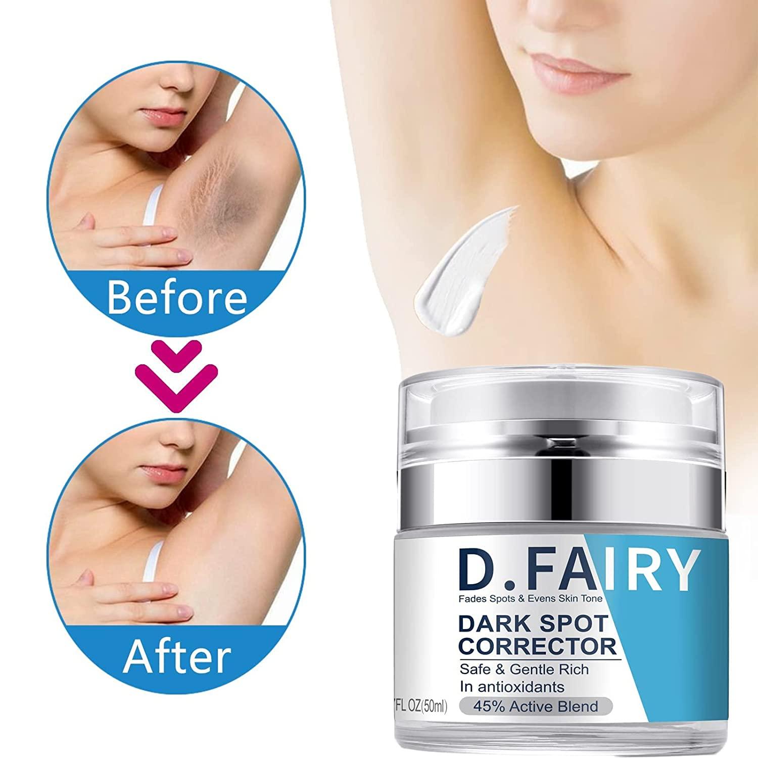 Dark Spot Cream for Body, Face and Sensitive Areas, Underarm Bleaching