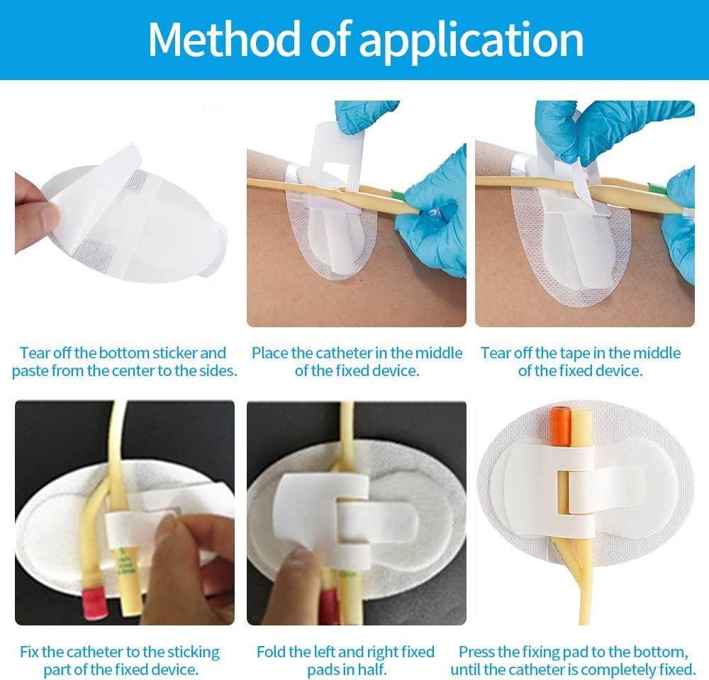 Atacesotaiv 5 pcs Catheter Stabilization Device,Adhesive Sticker for
