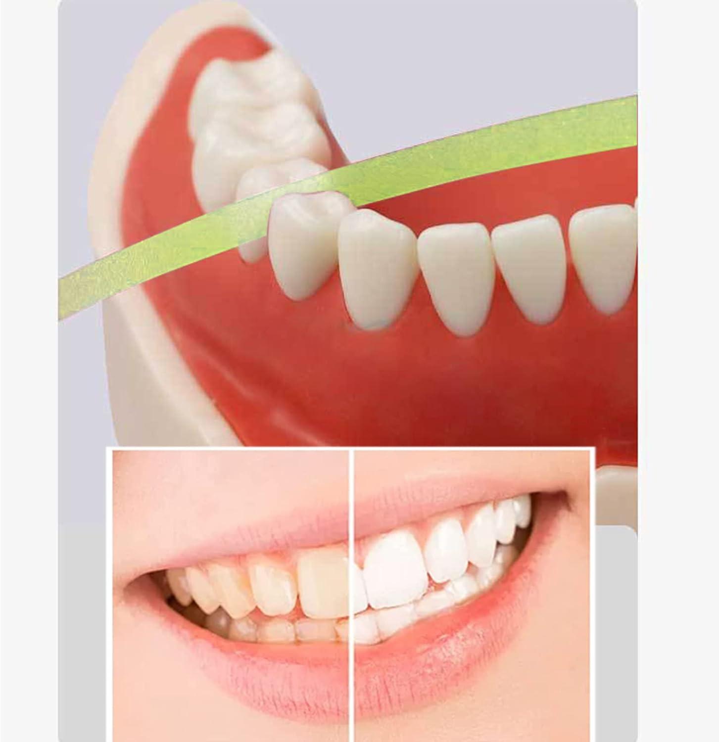 Dental Polishing Strips 20um Teeth Abrasive Strip for Whitening and Interdental Grinding 4mm