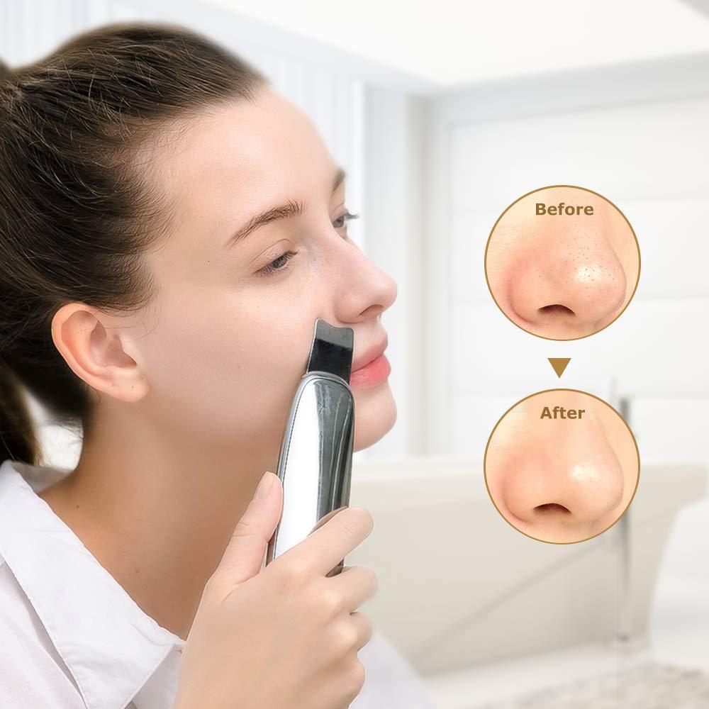 TOUCHBeauty Professional Facial Scrubber Spatula Cordless Blackheads Remover Comedones Extractor