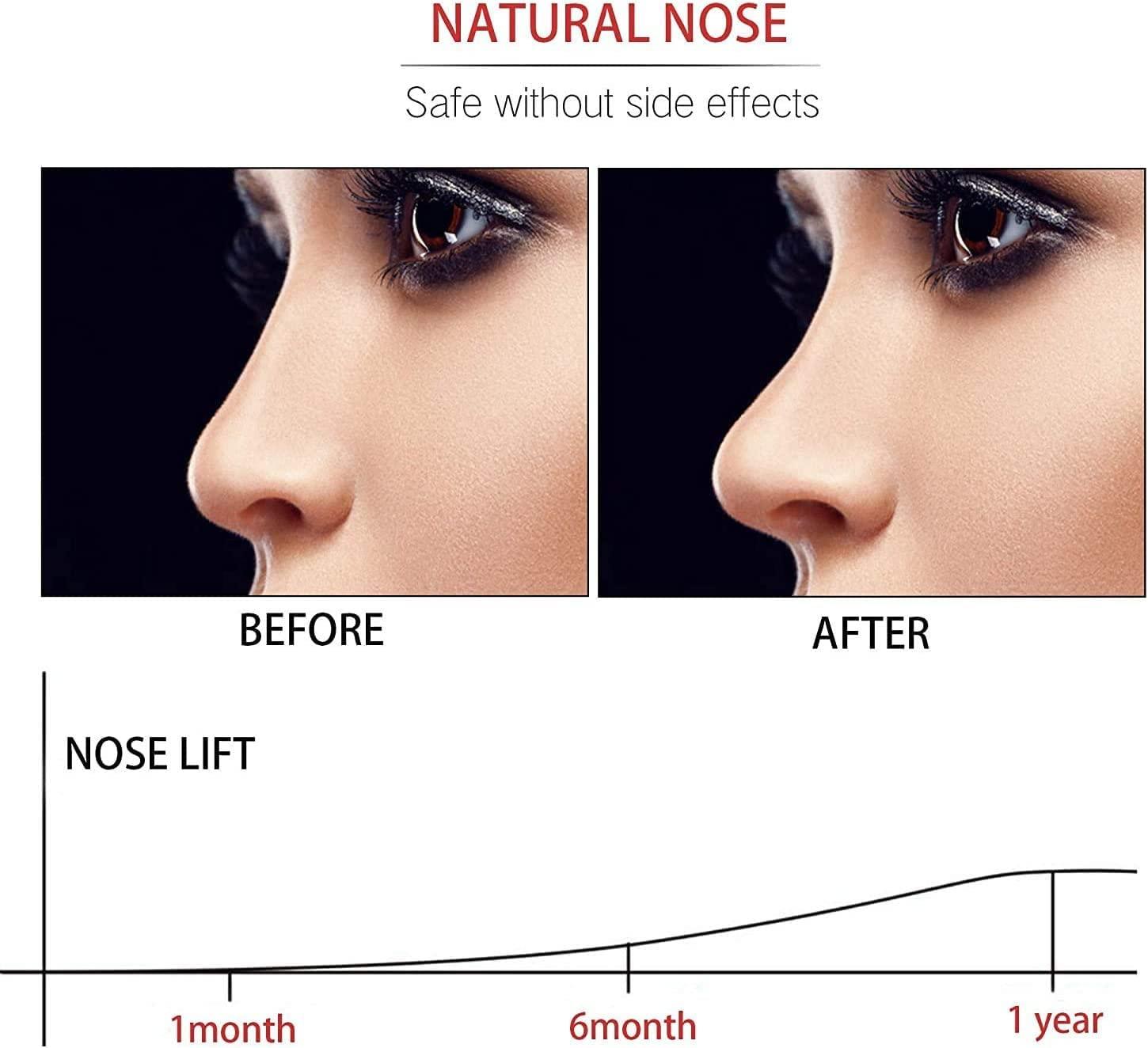 Nose Shaper Silicone Nose Lifter Clip Nose Bridge Straightener Corrector  Nose Slimmer Device Nose Up Lifting Clips Tool for Wide Noses Beauty Tool  White1
