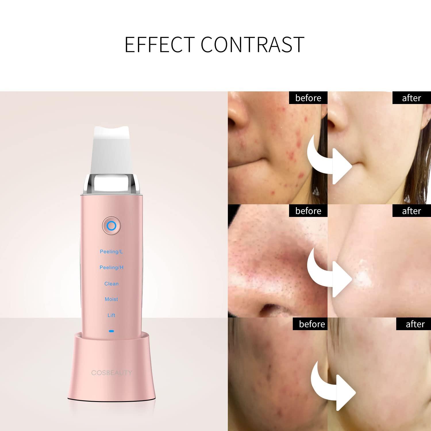 COSBEAUTY Skin Scrubber Skin Spatula | 4-in-1 Versatile