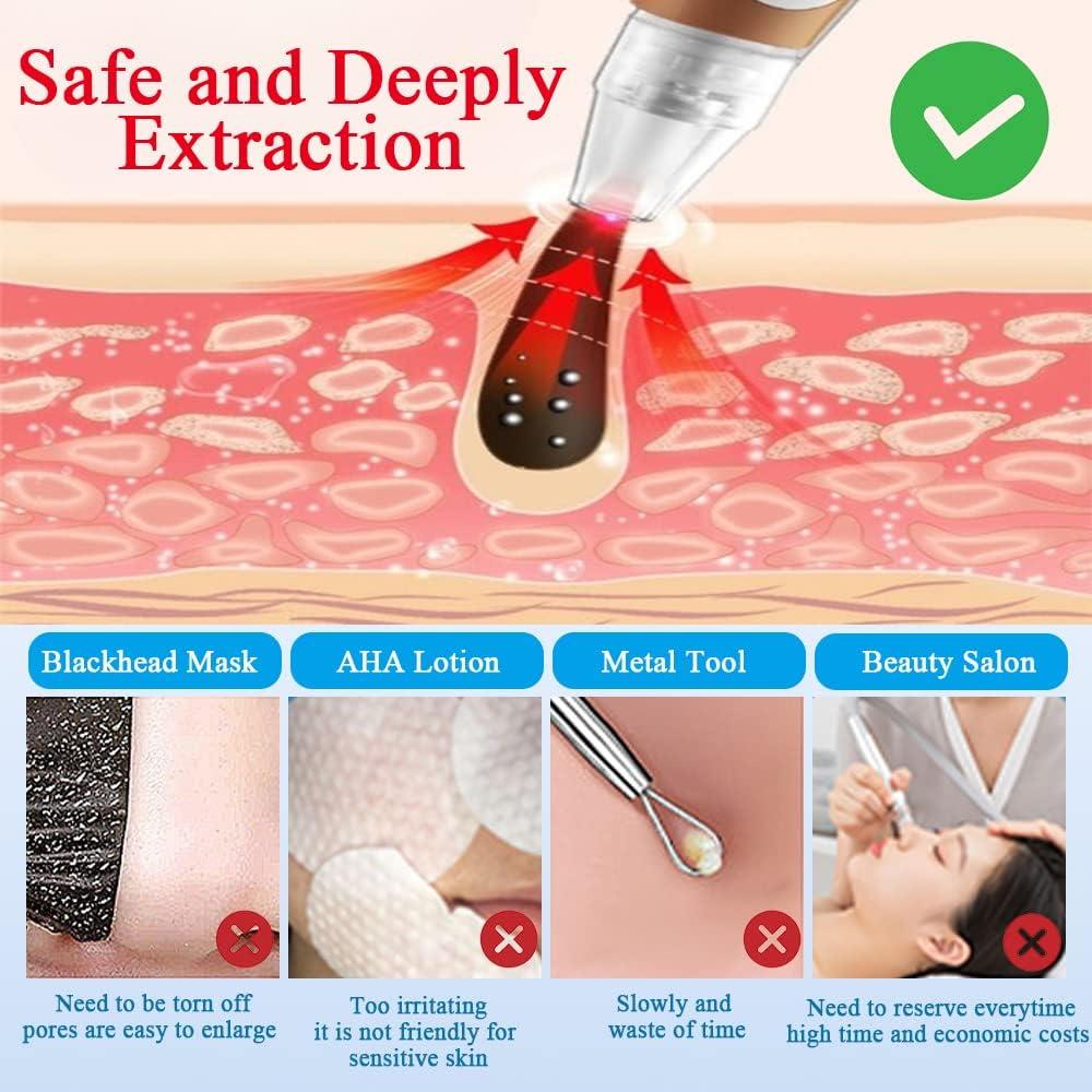 2023 Blackhead Remover Vacuum Kit 6 Probes, Facial Cleaner for Face