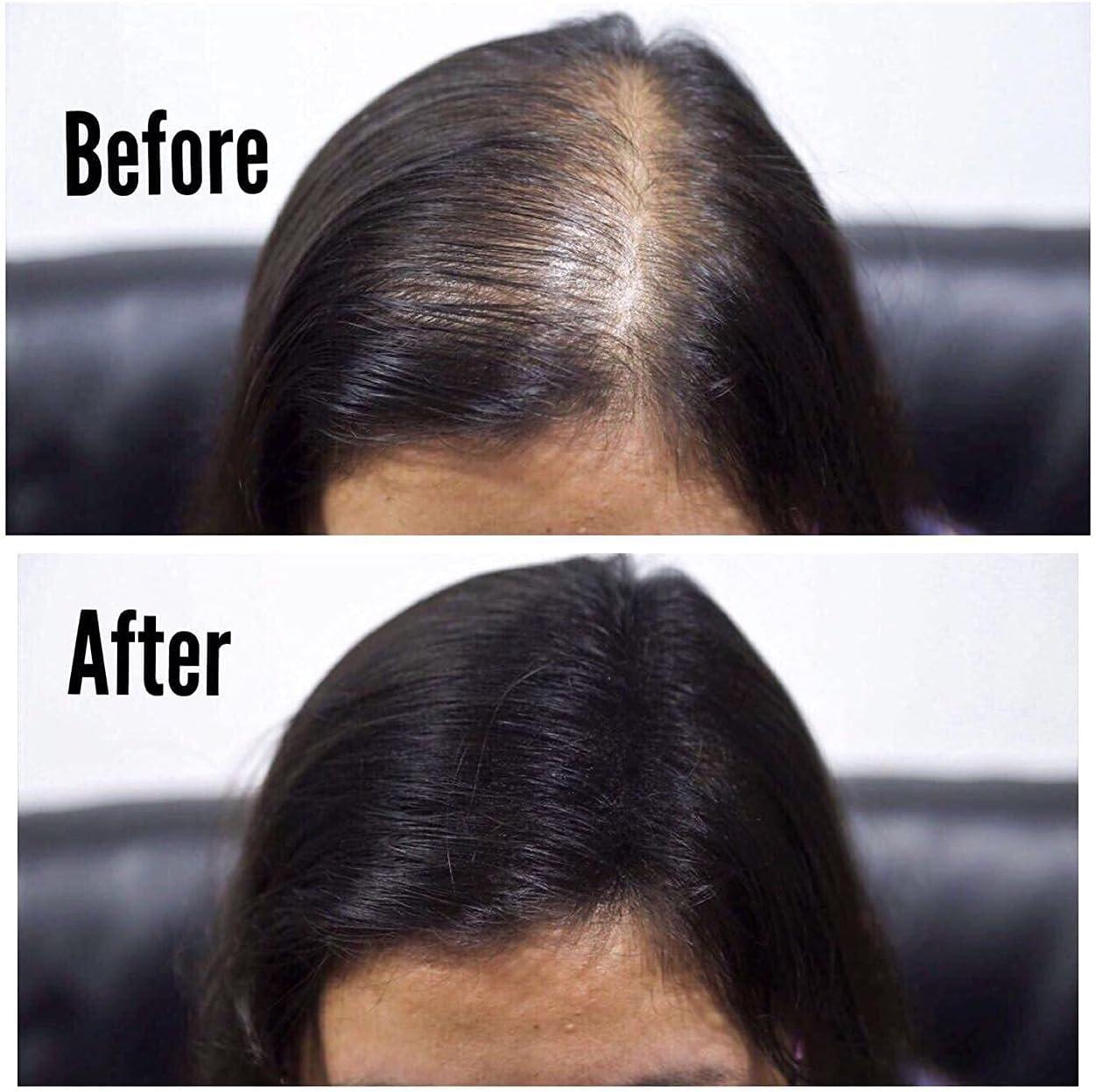 THICK FIBER Hair Fibres (Pack Of 1, BLACK) | Powder For Thinning 25g