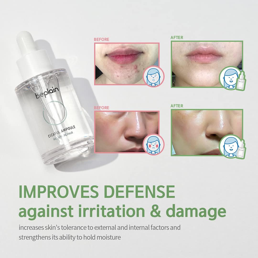 beplain Centella Acne Serum (1.01 fl.oz) Hyaluronic Acid Hydrating Spot Corrector Korean