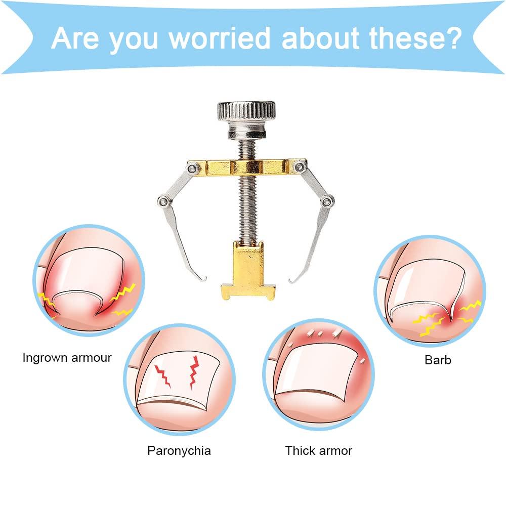 Ingrown Toenail Corrector Professional Ingrown Toenail Lifter Practical