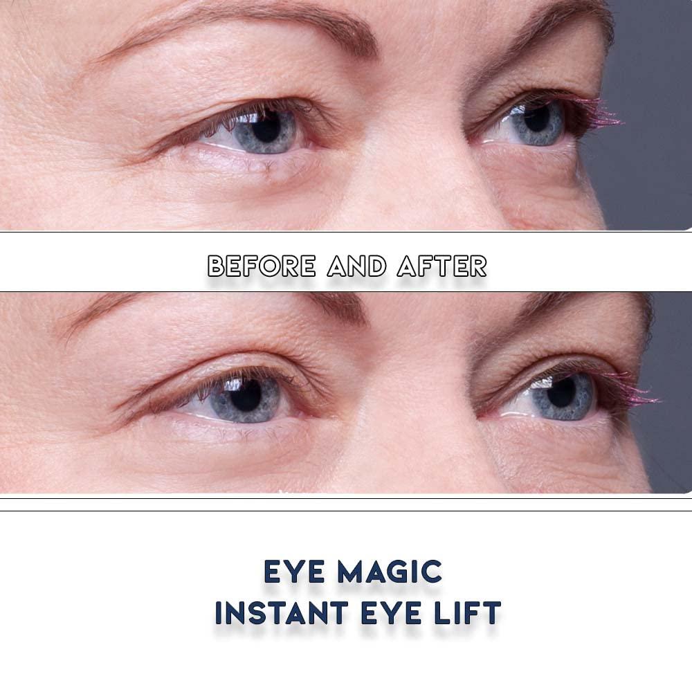 Eye Magic Instant Eyelid Lift Youthful Look SM Kit wGel Made in USA