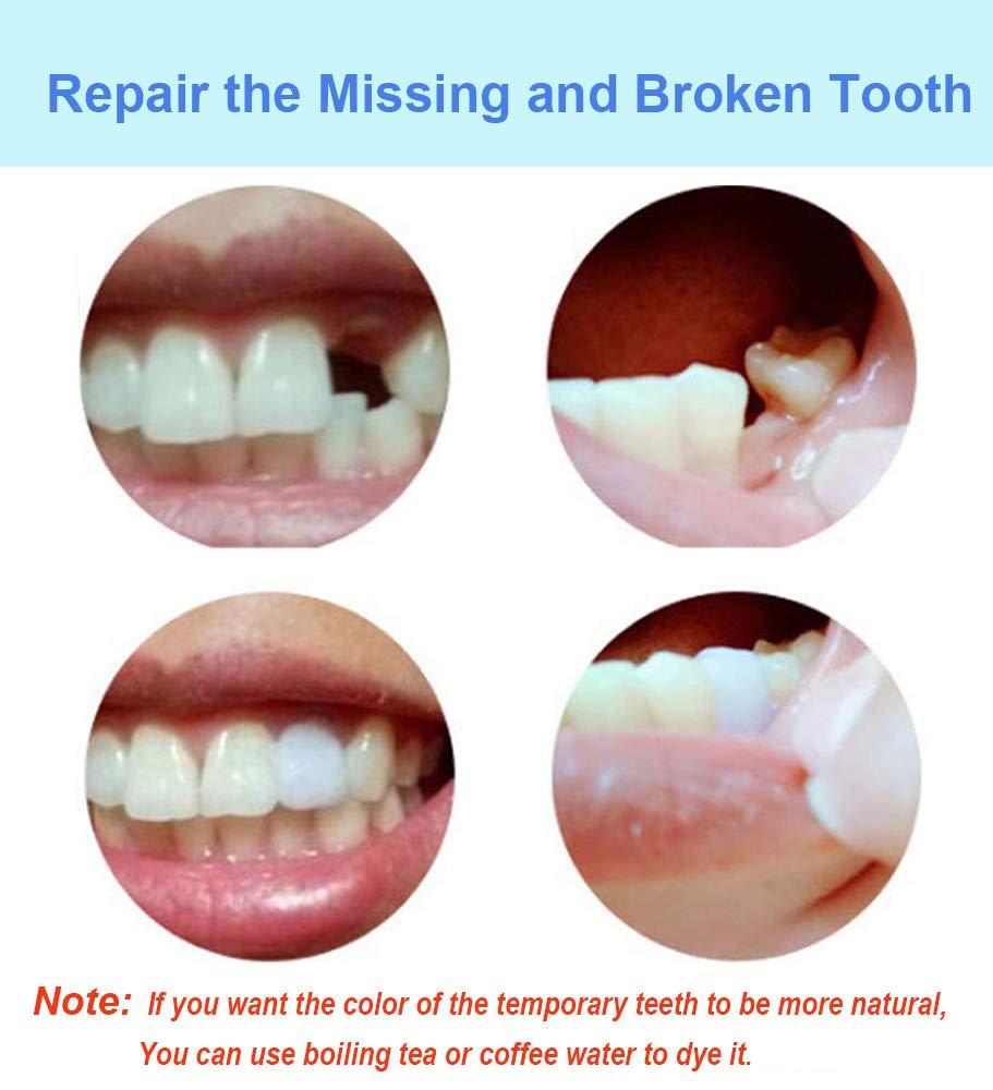 2*Moldable False Teeth Temporary Tooth Repair Kit For Filling The Missing  Broken