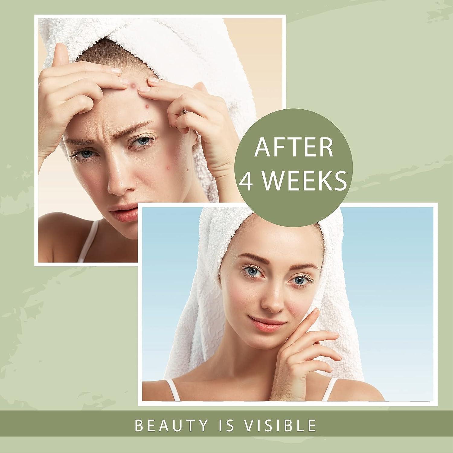 OSITO LED Light Therapy Facial Mask Acne Treatment & AntiAging Red