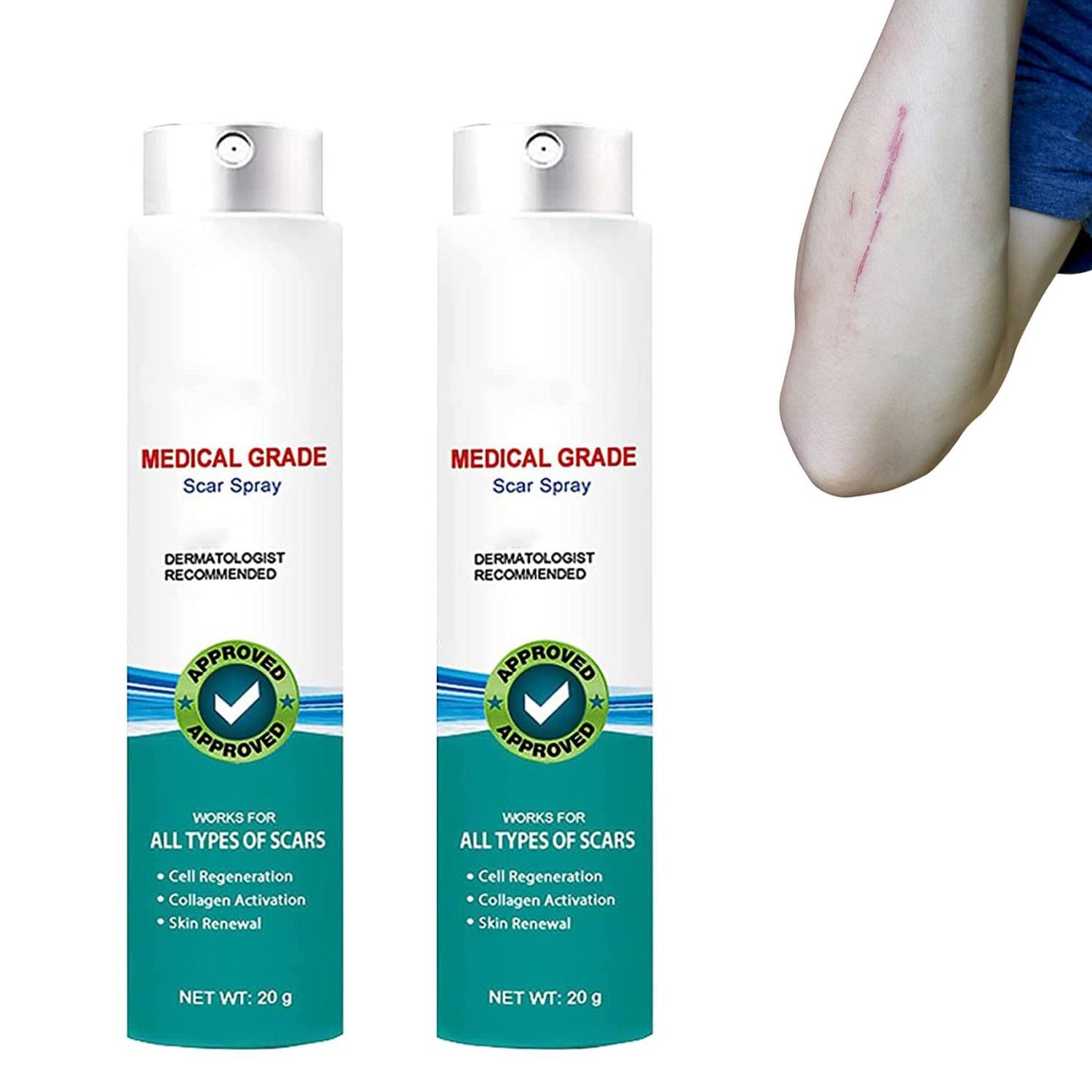 Proregen Medical Scar Removal Spray Scarremove Advanced Scar Spray for