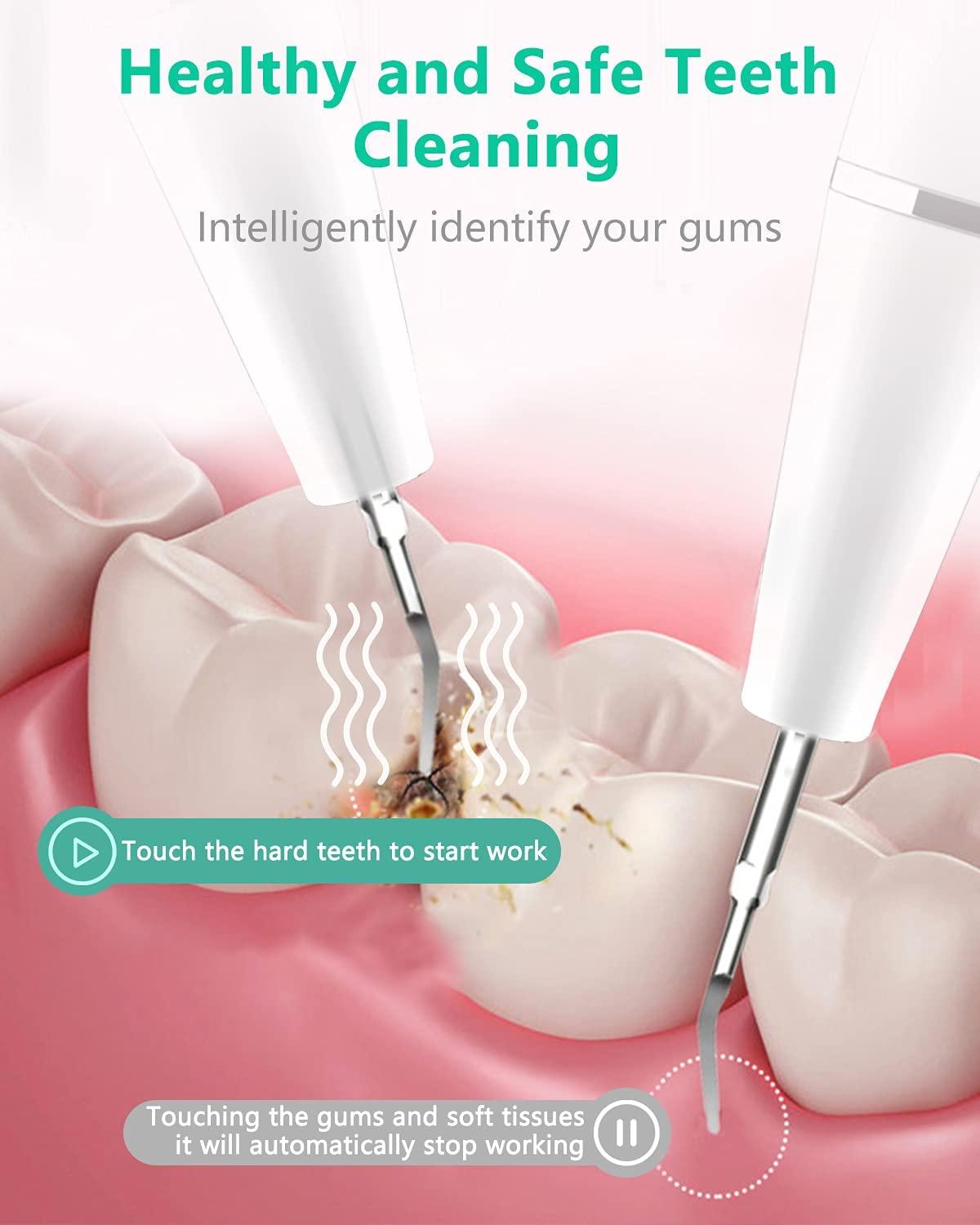 Ultrasonic Tooth Cleaner Plaque Remover with LED and 3 Modes Safe