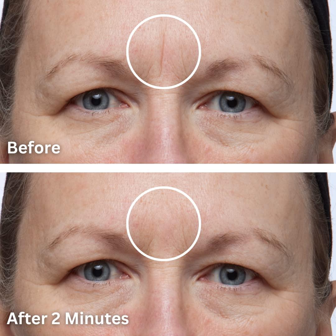 Dermaflage Scar Filler Kit Deep Scar Cover and Waterproof Concealer