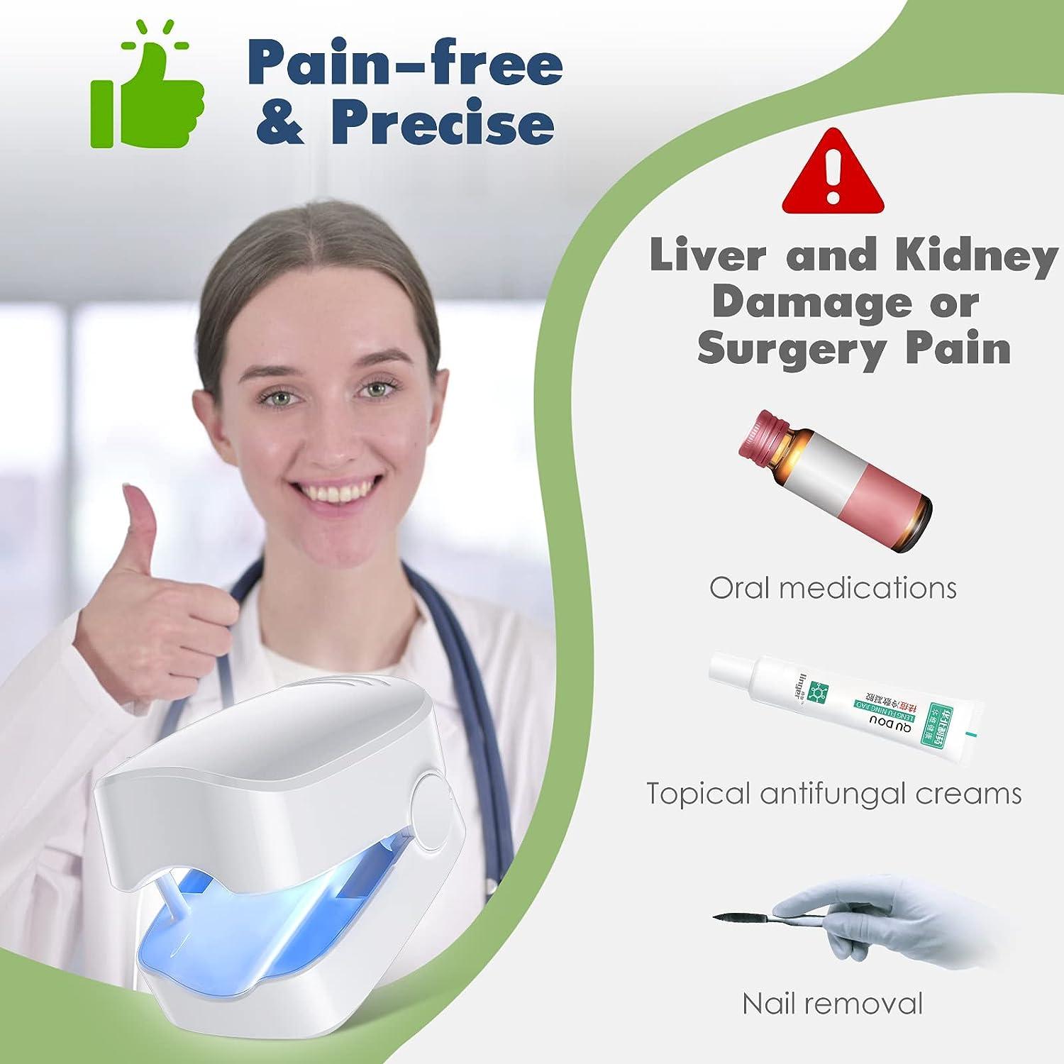 Nail Fungus Laser Treatment Device Blue Light Therapy for