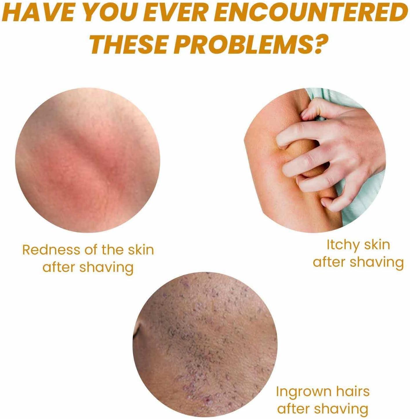 After Shave Essence | 90Ml Razor Bump Stopper Solution For Ingrown Hair ...