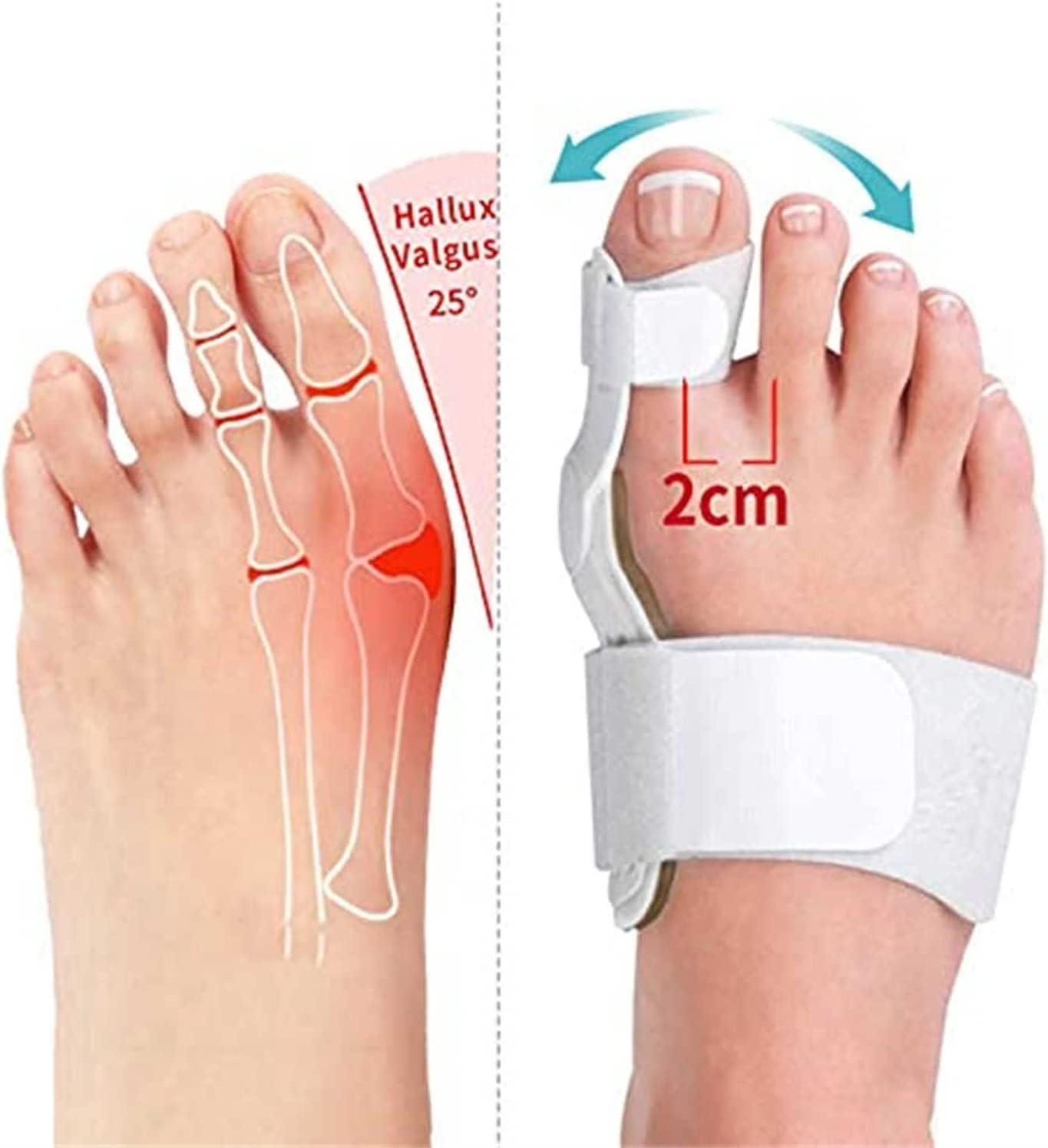 OBODN 6 Pcs Orthopedic Toe Bunion Corrector Splint Support Flexible