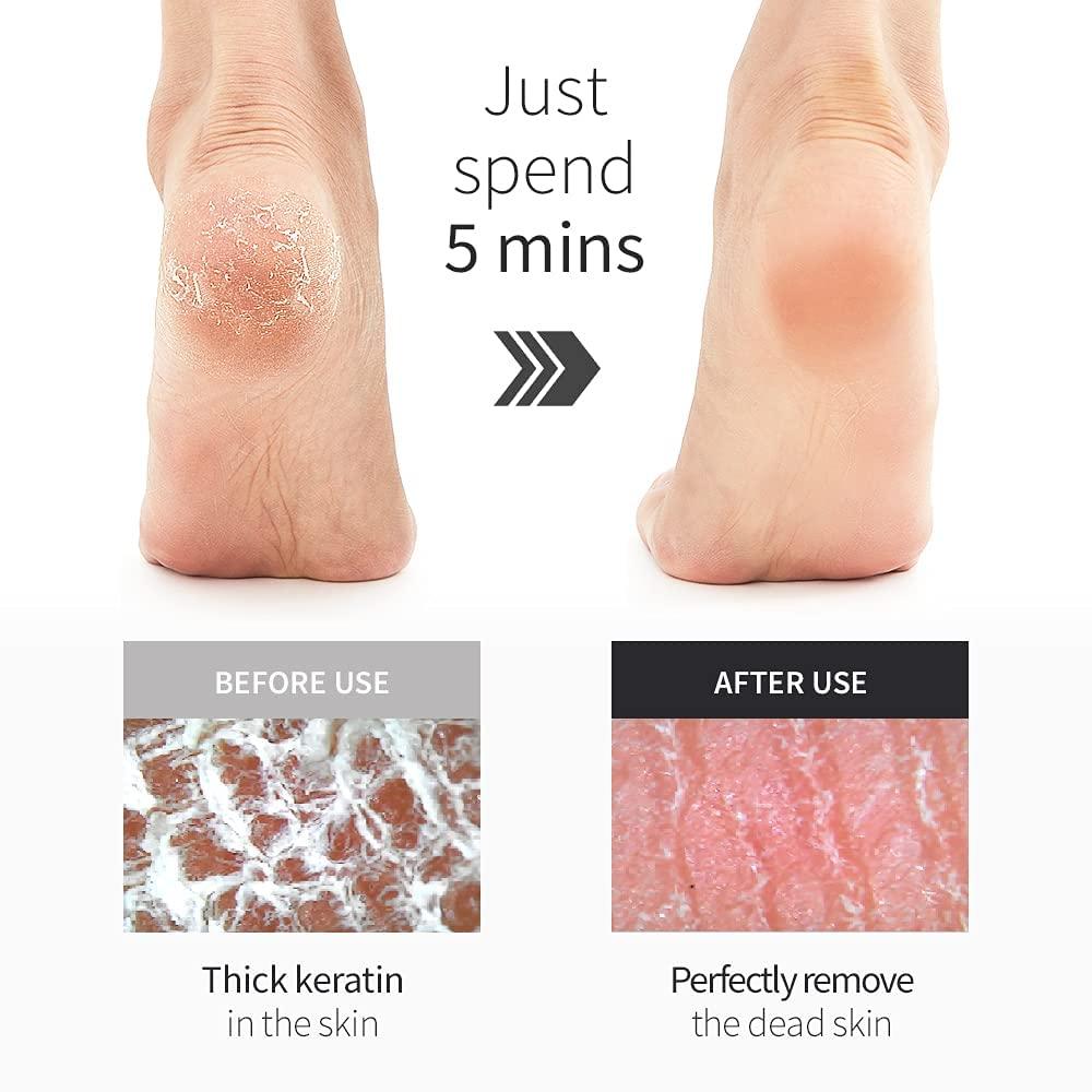 Hypoallergenic Glass Foot Rasp File and Callus Remover with Glass-Etching  Technology for Dry or Wet Feet (Irritation-Free Pedicure Tools, Pedi/Feet