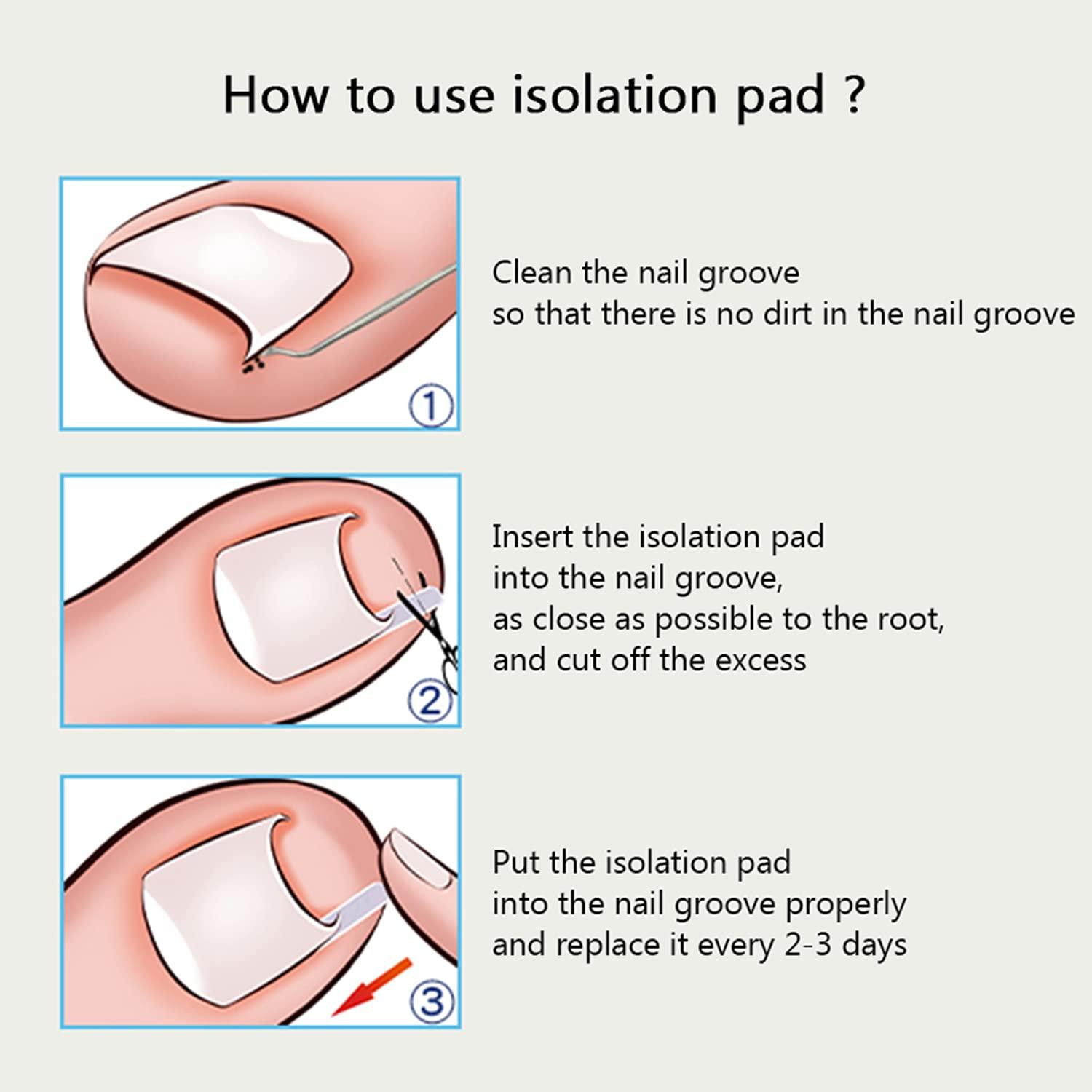 (60+2) Pack Ingrown Toenail Treatment, Include 60 PCS Ingrown Toenail
