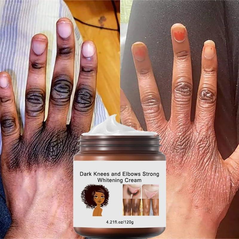 Crema LÃ¡ser Para Blanquear Entrepierna 2pcs Crema Aclaradora Para Piel  Manchas En Cara Axilas Cuello